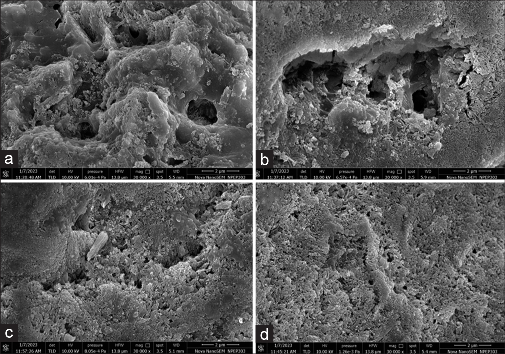 FE-SEM analysis at ×30,000 – (a) demineralized surface, (b) remineralization with sodium fluoride, (c) theobromine gel, and (d) nano-hydroxyapatite paste. FE-SEM: Field emission scanning electron microscopy.
